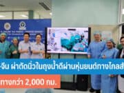 ไทย-จีน ผ่าตัดนิ่วในถุงน้ำดีผ่านหุ่นยนต์ทางไกล